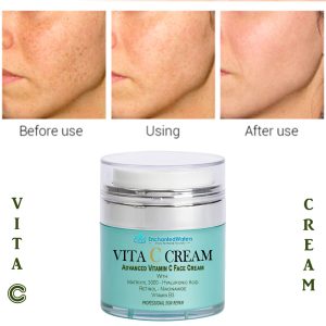 Matrixyl 3000 Peptide Hyaluronic Acid Retinol Collagen Vitamin C Cream Anti Aging.